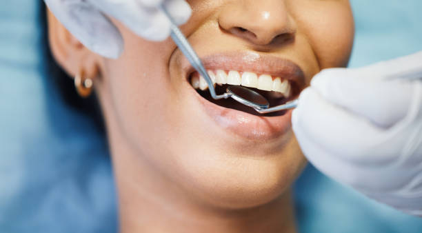 Best Cracked Tooth Emergency Dentist  in Riva, MD